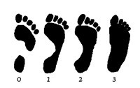 Pėdos plokščiapėdystė priežastys. Pėdų gydymas mankšta, stiprinimas pratimais
