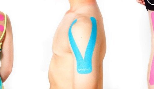 Kineziterapija - Kinezioteipai - Kinezioteipavimas - Kinezioteipas medicininis kineziterapinis teipavimo pleistras - Kineziterapinis teipavimo taikymas - Teipavimo būdai metodika - Kinesio tape kinezio teipo poveikis - Kineziologinis raumenų teipavimas - Teipavimo metodikos - Kaip teipuoti kūdikiams?