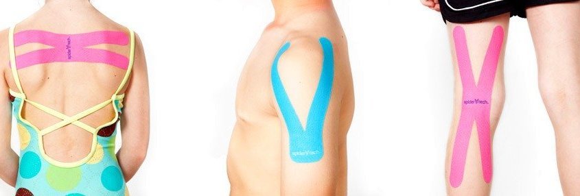 Kineziterapija - Kinezioteipai - Kinezioteipavimas - Kinezioteipas medicininis kineziterapinis teipavimo pleistras - Kineziterapinis teipavimo taikymas - Teipavimo būdai metodika - Kinesio tape kinezio teipo poveikis - Kineziologinis raumenų teipavimas - Teipavimo metodikos - Kaip teipuoti kūdikiams?